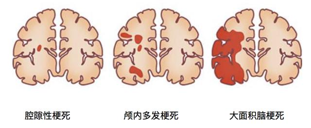74a7b3058c7c4f13b1af1908efd5b1d8.png