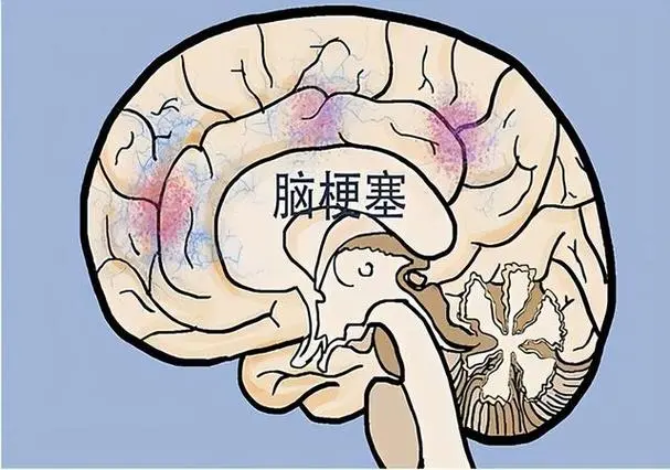 74a7b3058c7c4f13b1af1908efd5b1d8.png