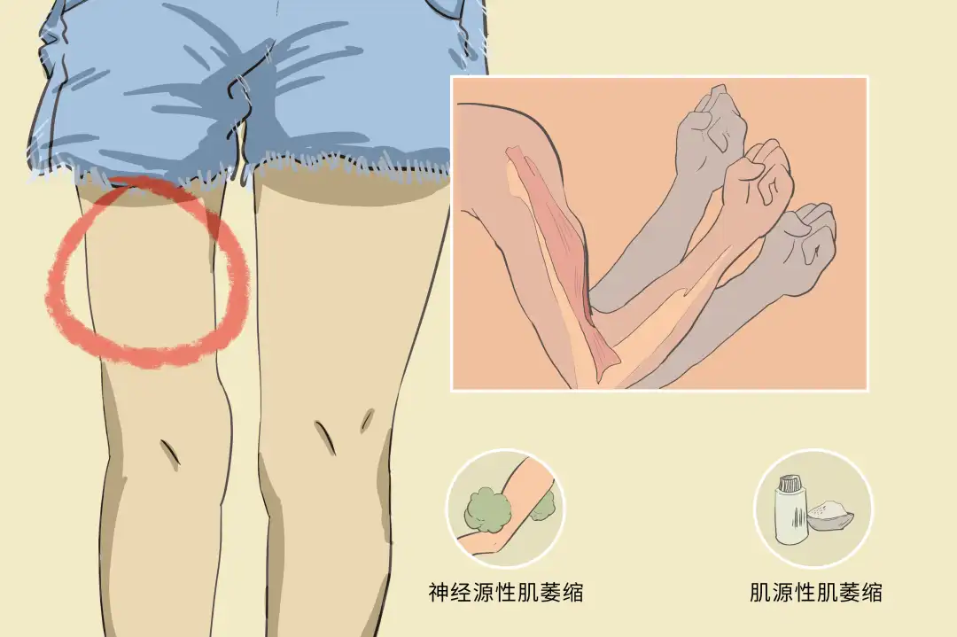 冬季肌肉萎缩护理:避免病情恶化的实用技巧