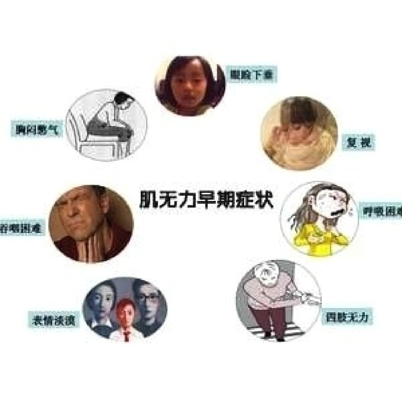 食疗之道:肌营养不良患者如何通过饮食增强肌肉力量?
