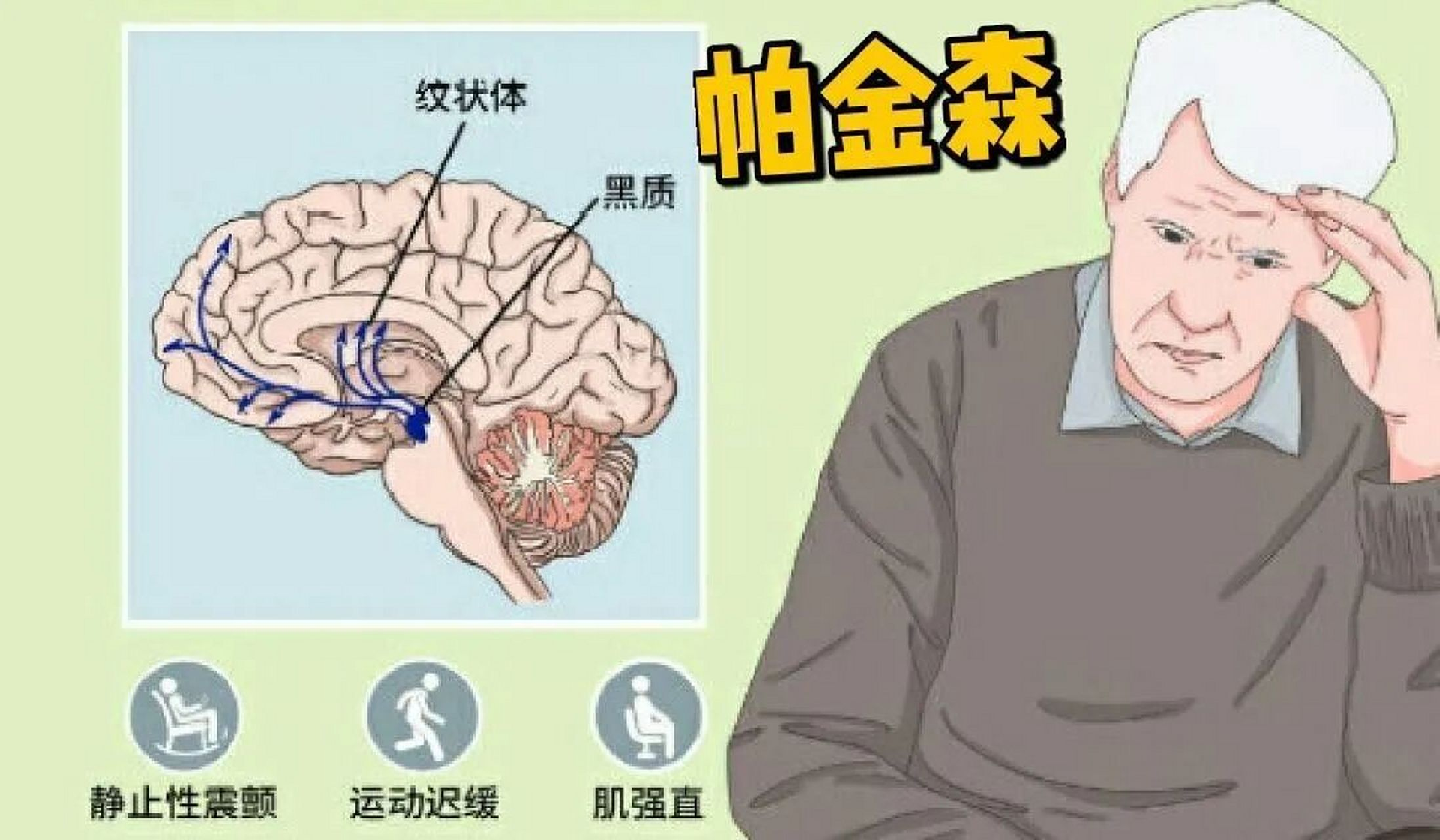 帕金森后期最严重的症状表现有哪些?