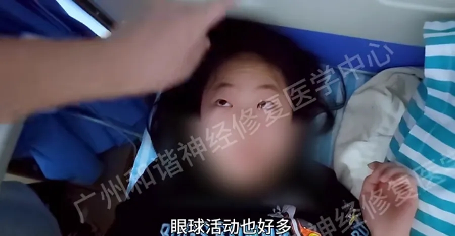 【查房日记】神经修复显奇效!12岁女孩重症肌无力症状大改善,眼睛睁得更大更明亮!