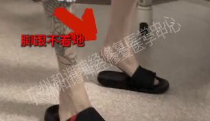 【案例纪实】19 岁青年,被马蹄内翻足困扰十年,他如何一步步走向 “平衡” 人生的?