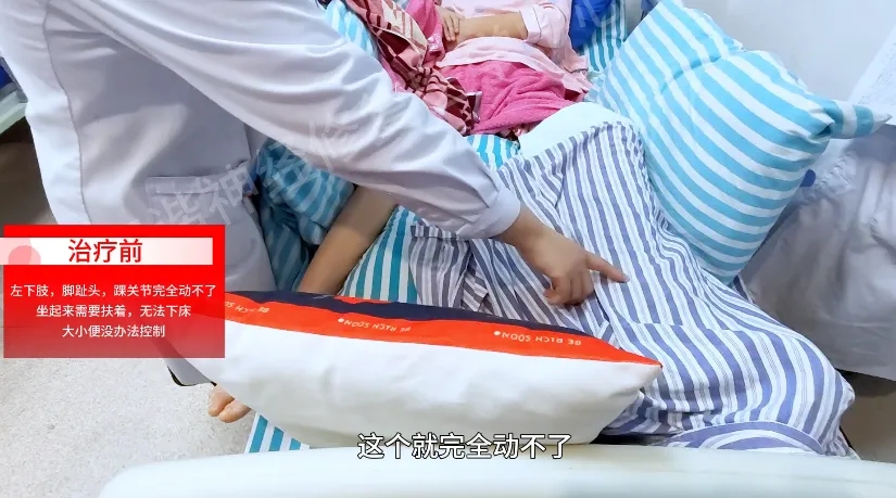 【案例纪实】少女意外跌落致脊髓损伤,神经修复与汗水勇气共铸康复之花