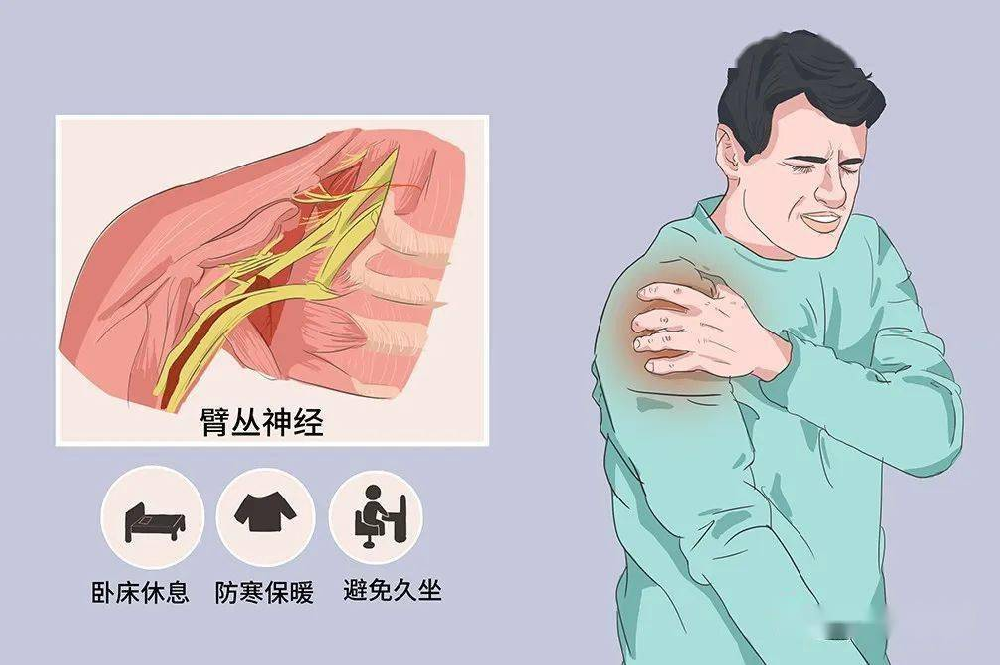 “我等了3个月,手还是抬不起来……”——臂丛神经损伤自愈的残酷真相