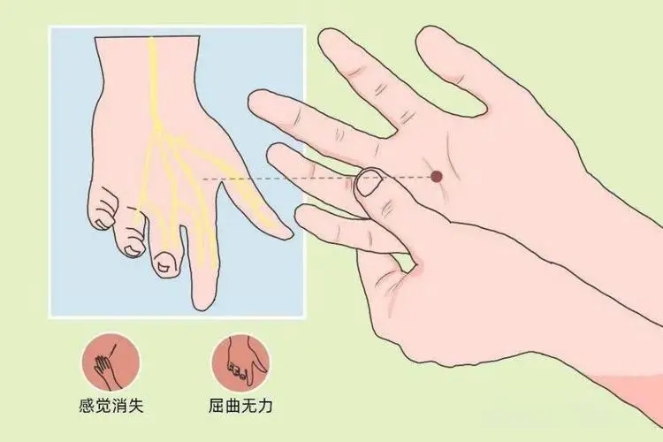 【查房日记】手抖、无力、写字歪斜?神经损伤在作祟!神经修复助其书写新生|广州神经损伤多久能恢复?