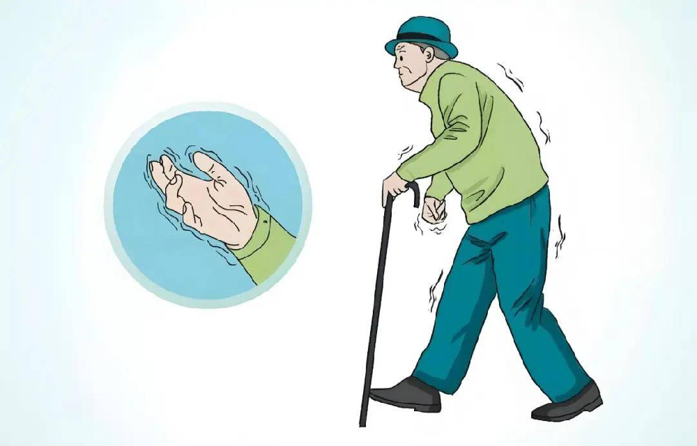 帕金森患者步行训练：3个动作+2个辅助工具，降低跌倒风险