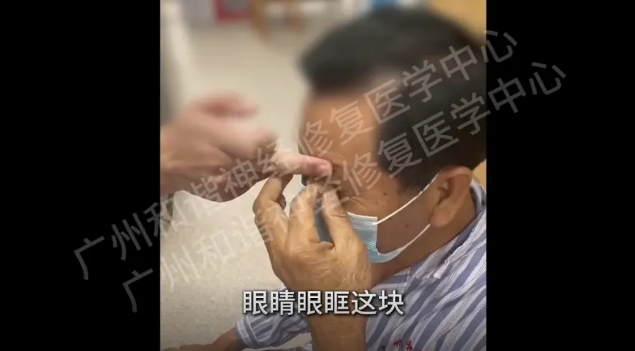 【案例纪实】六年带状疱疹痛如 “精神酷刑”！发作时痛不欲生，微创技术一针终结剧痛，助他回归正常生活！广州带状疱疹能自愈吗？