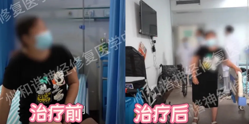 【纪实案例】脑梗死偏瘫无法下床行走？神经修复显奇效，如今已能扶床独立行走|广州脑梗死偏瘫多久能恢复肌力