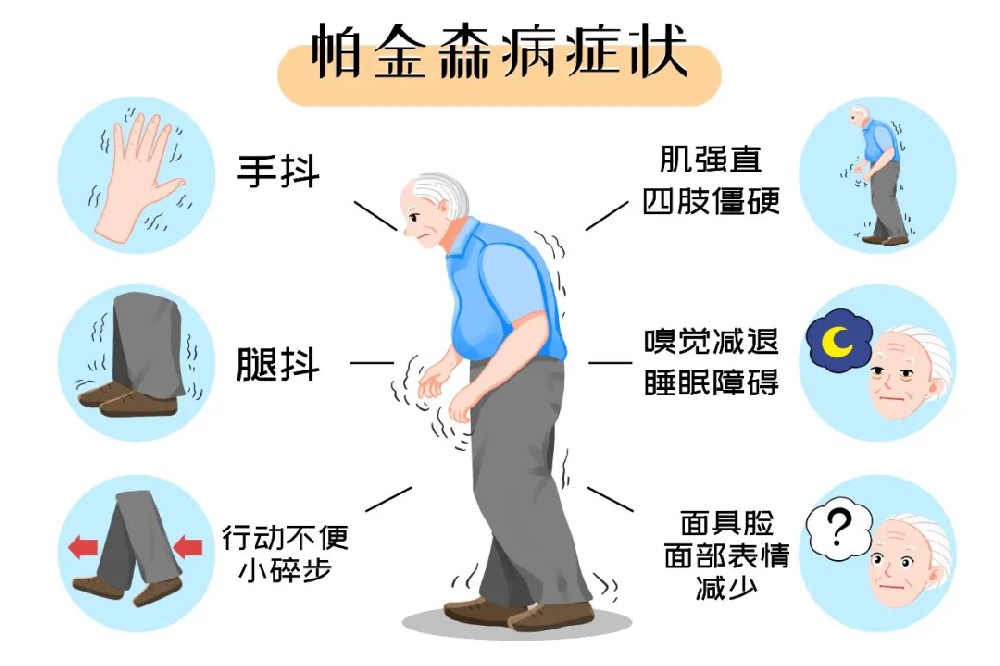 【纪实案例】被帕金森冻住一年多?肢体发僵？活动受限？神经修复显效，成功摆脱抖僵慢困扰，行动灵活