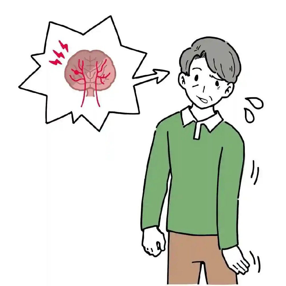 5种脑梗类型,快来看看对照判断自身风险