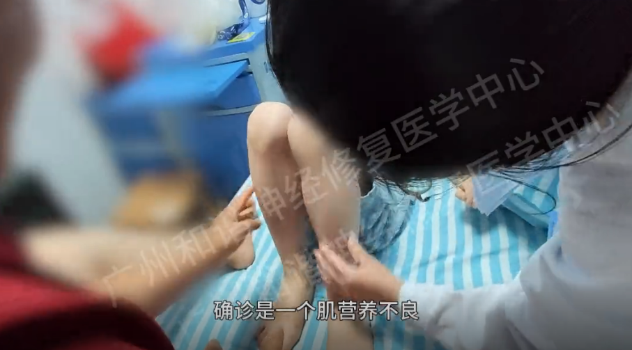 【纪实案例】肌营养不良患儿的曙光:神经修复破无力之茧,肌力渐强焕新生|广州肌营养不良去哪里医院治疗好