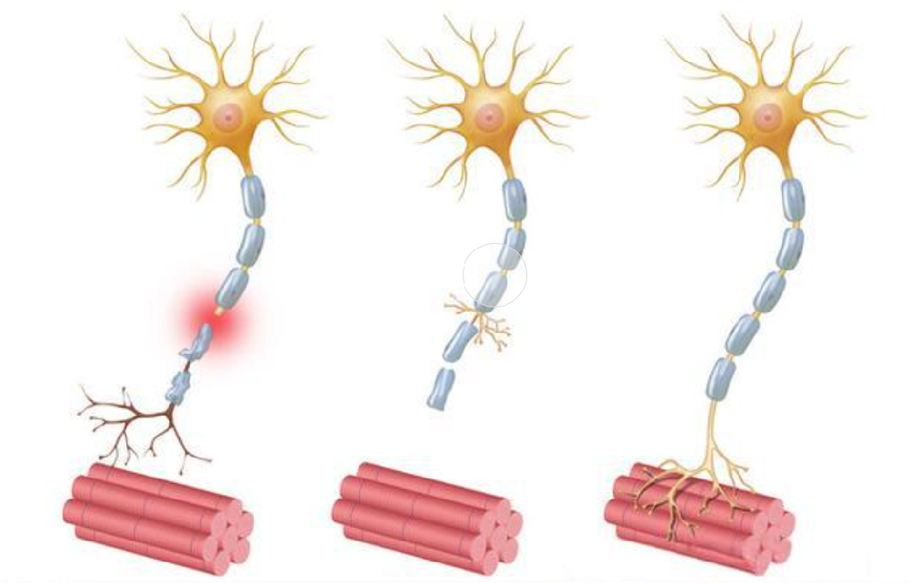 神经损伤后,多久才能恢复?