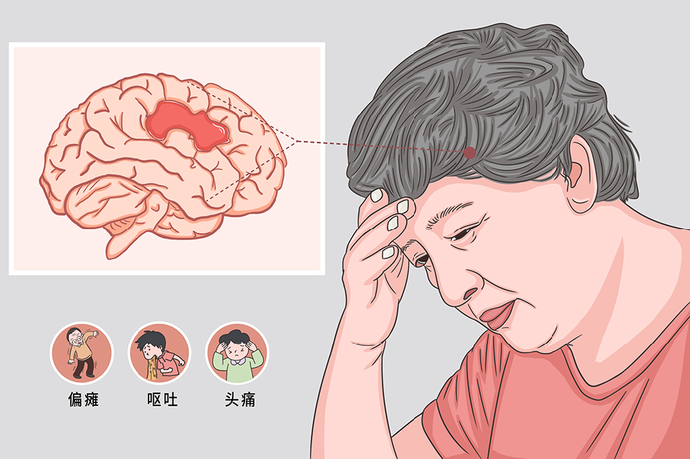寒冬护脑指南:给脑血管穿好