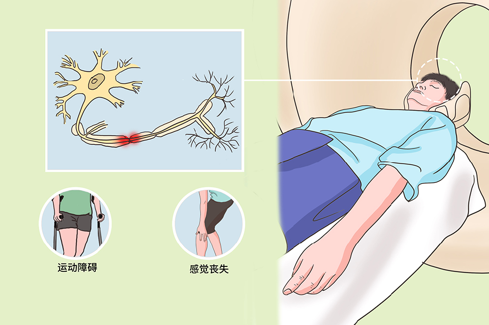 神经损伤后疼与不疼,对恢复影响有多大?