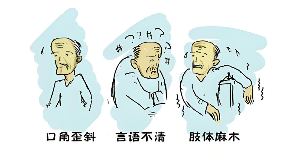 脑梗正年轻化!身体发出4个求救信号,千万别忽视