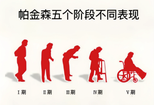 中医看帕金森:不只是“抖”,更需整体调养