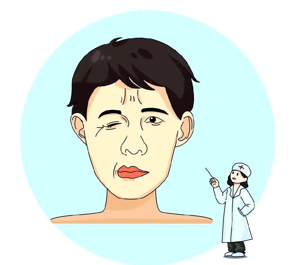 面肌痉挛千万别做!这5个禁忌动作,越做抽得越厉害