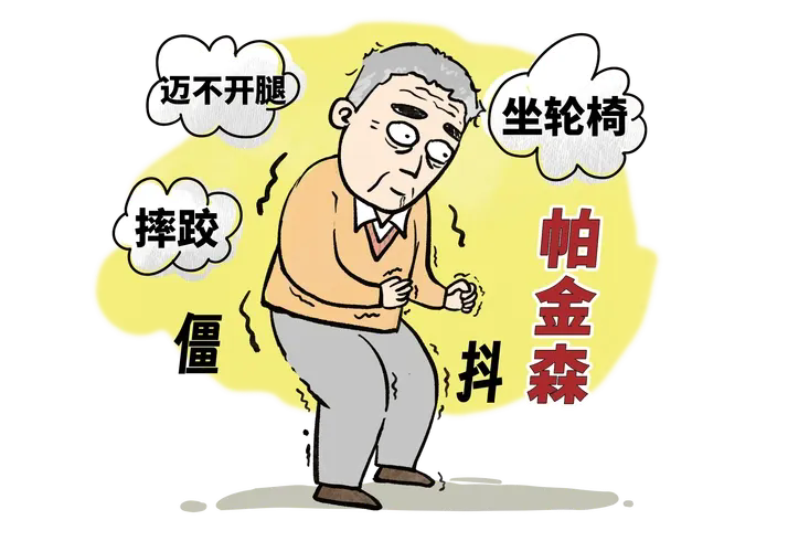 帕金森病:不只是“手抖”那么简单