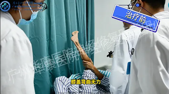 【案例实录】从“不敢走路”到“重新迈步”:一位腓骨肌萎缩症男孩的神经修复治疗实录