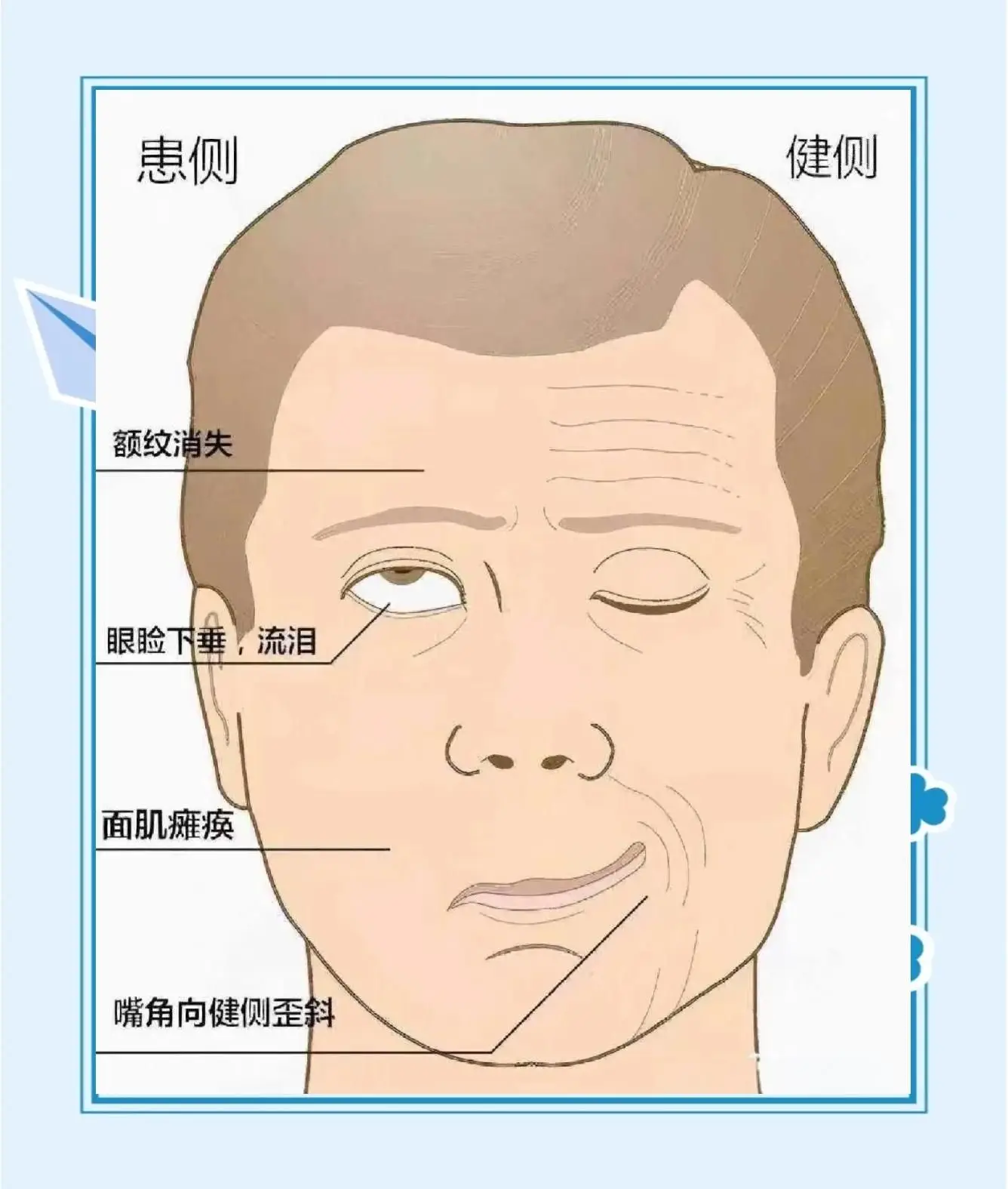 l.png